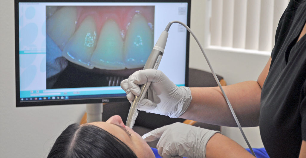 Image of a intraoral camera being used on a dental patient
