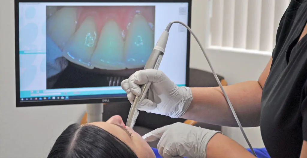 Intraoral camera in use at Stone Oak Family Dentistry